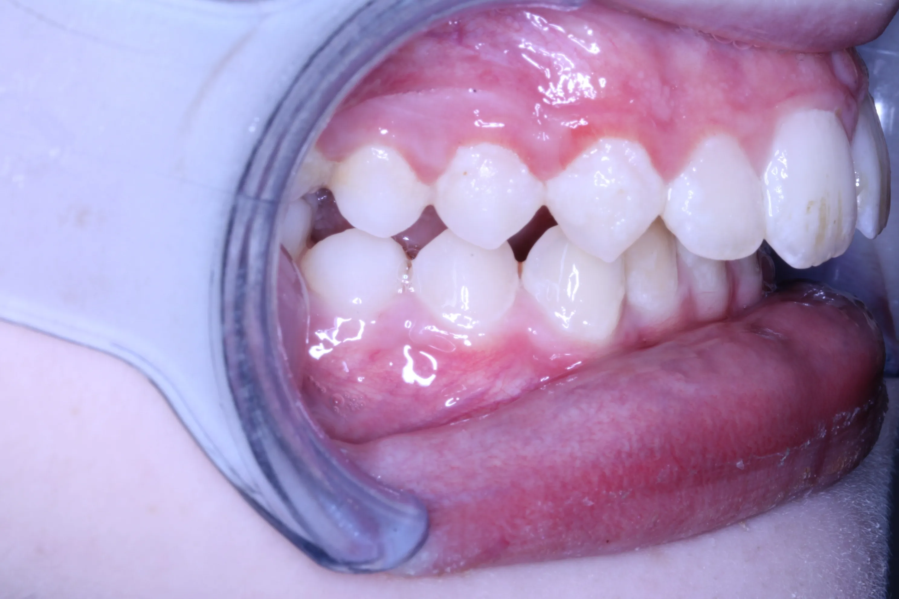 smile-gallery gallery